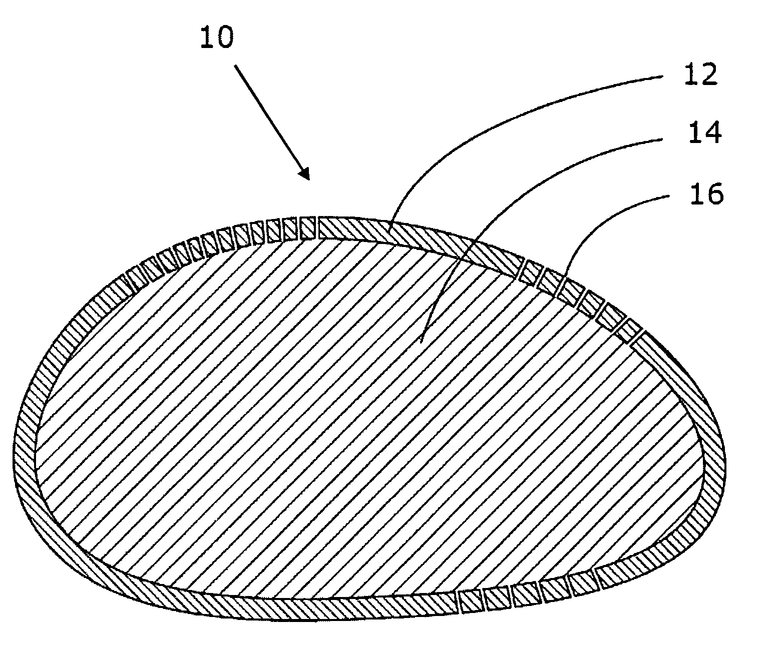 Biocompatible implant system and method