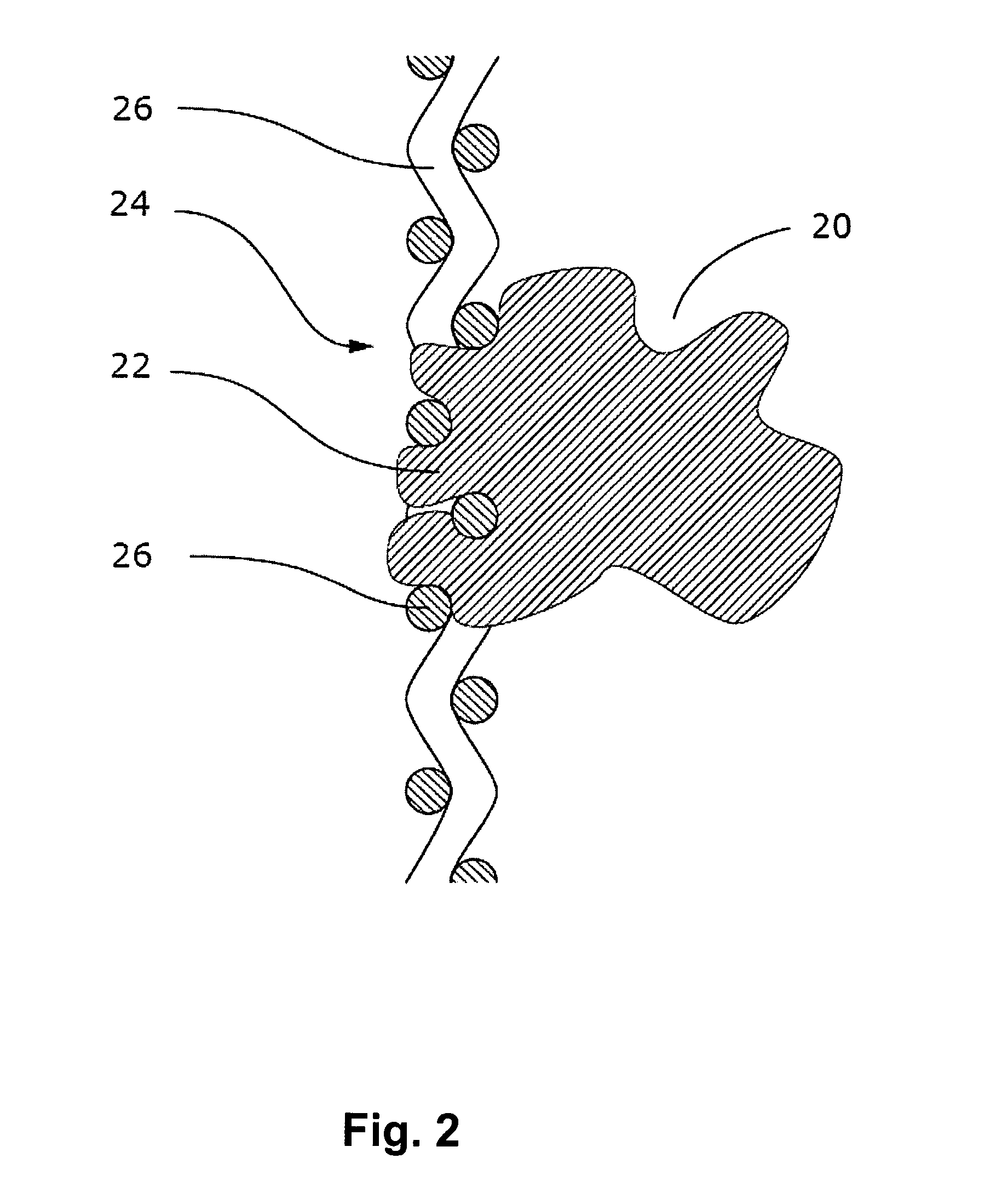 Biocompatible implant system and method