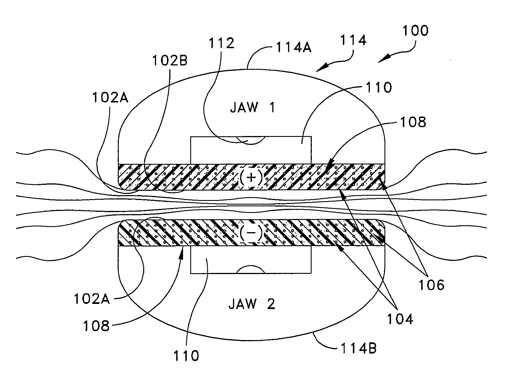 Apparatus for attachment and reinforcement of tissue, apparatus for reinforcement of tissue, methods of attaching and reinforcing tissue, and methods of reinforcing tissue