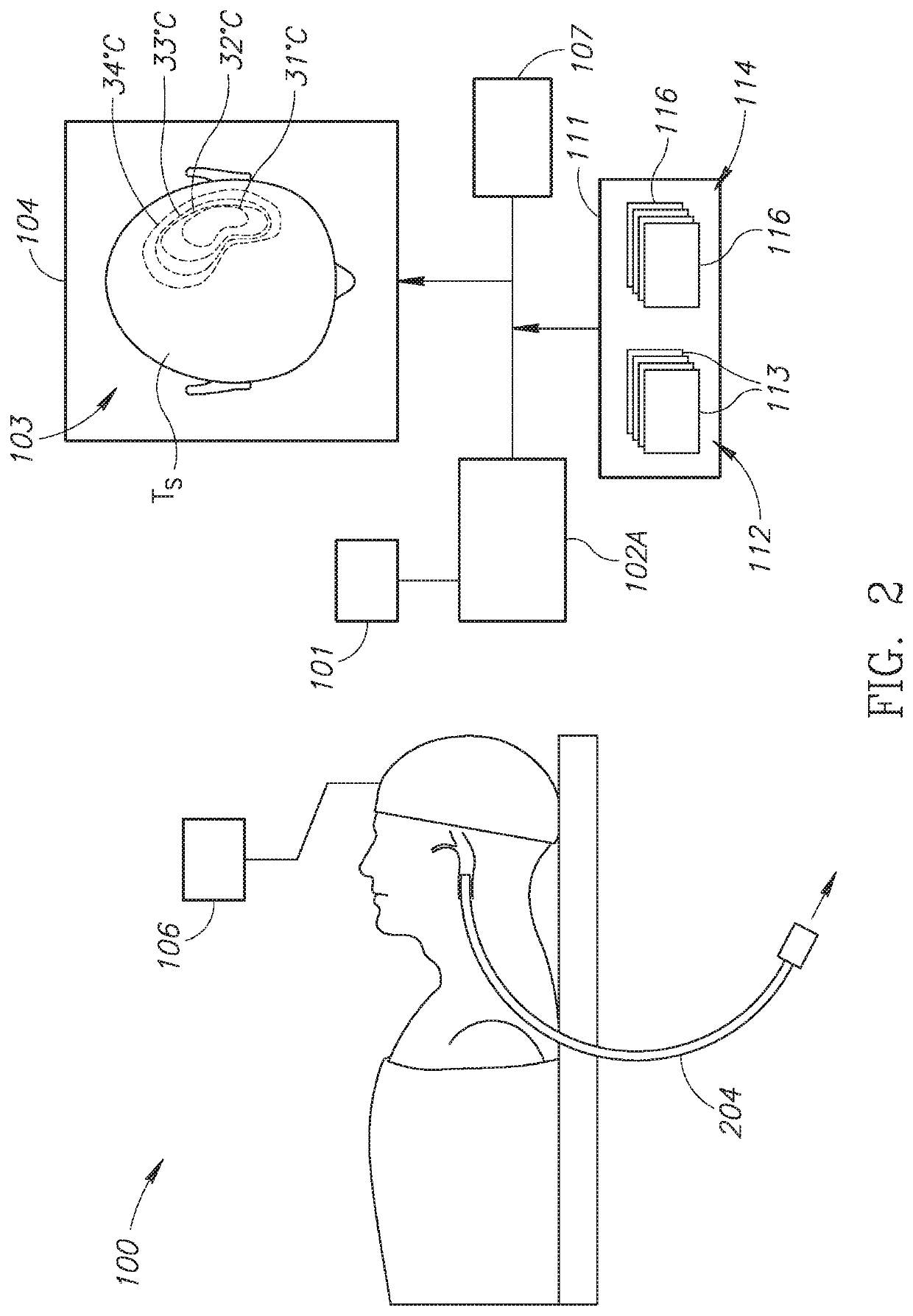 Neuroprotection apparatus