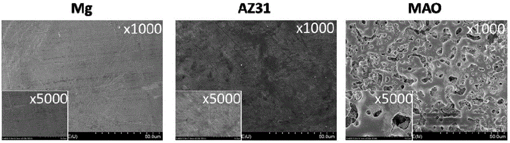 Application of magnesium material as oral cavity GTR or GBR membrane material