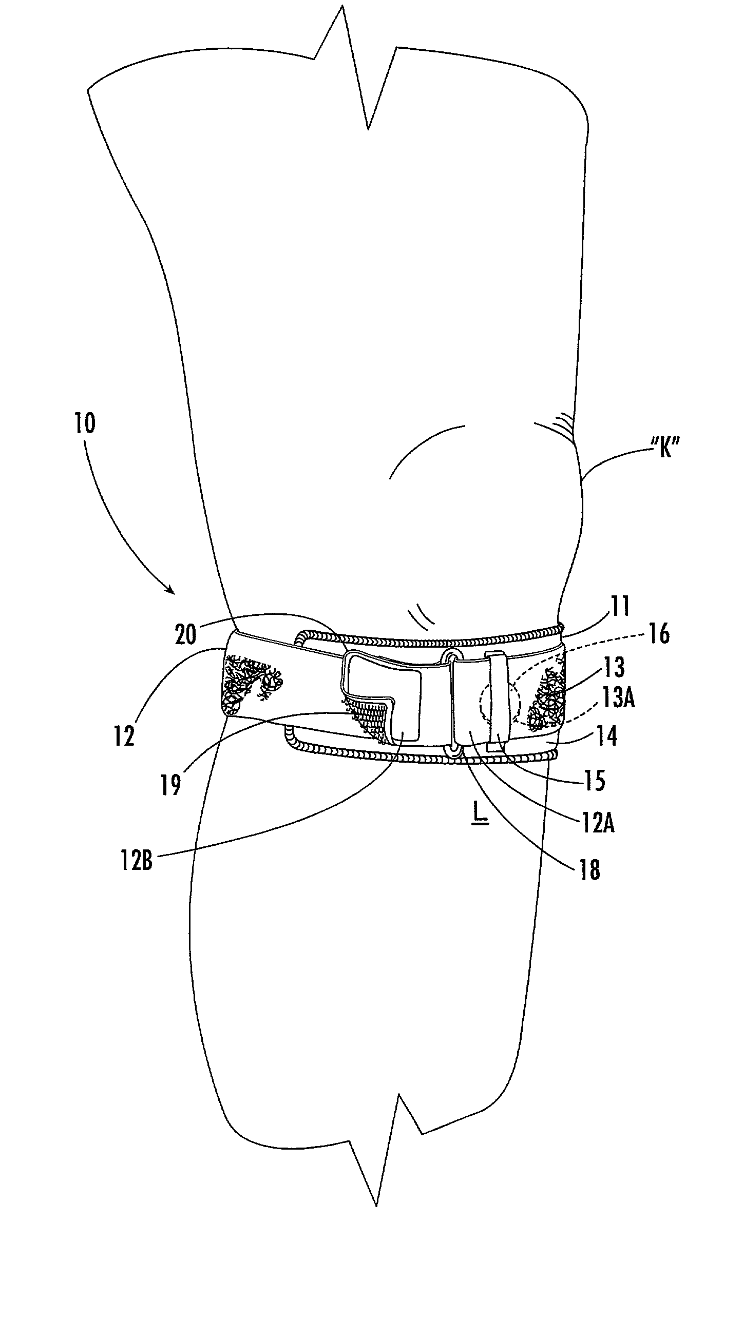 Custom-moldable support for patellar tendinitis