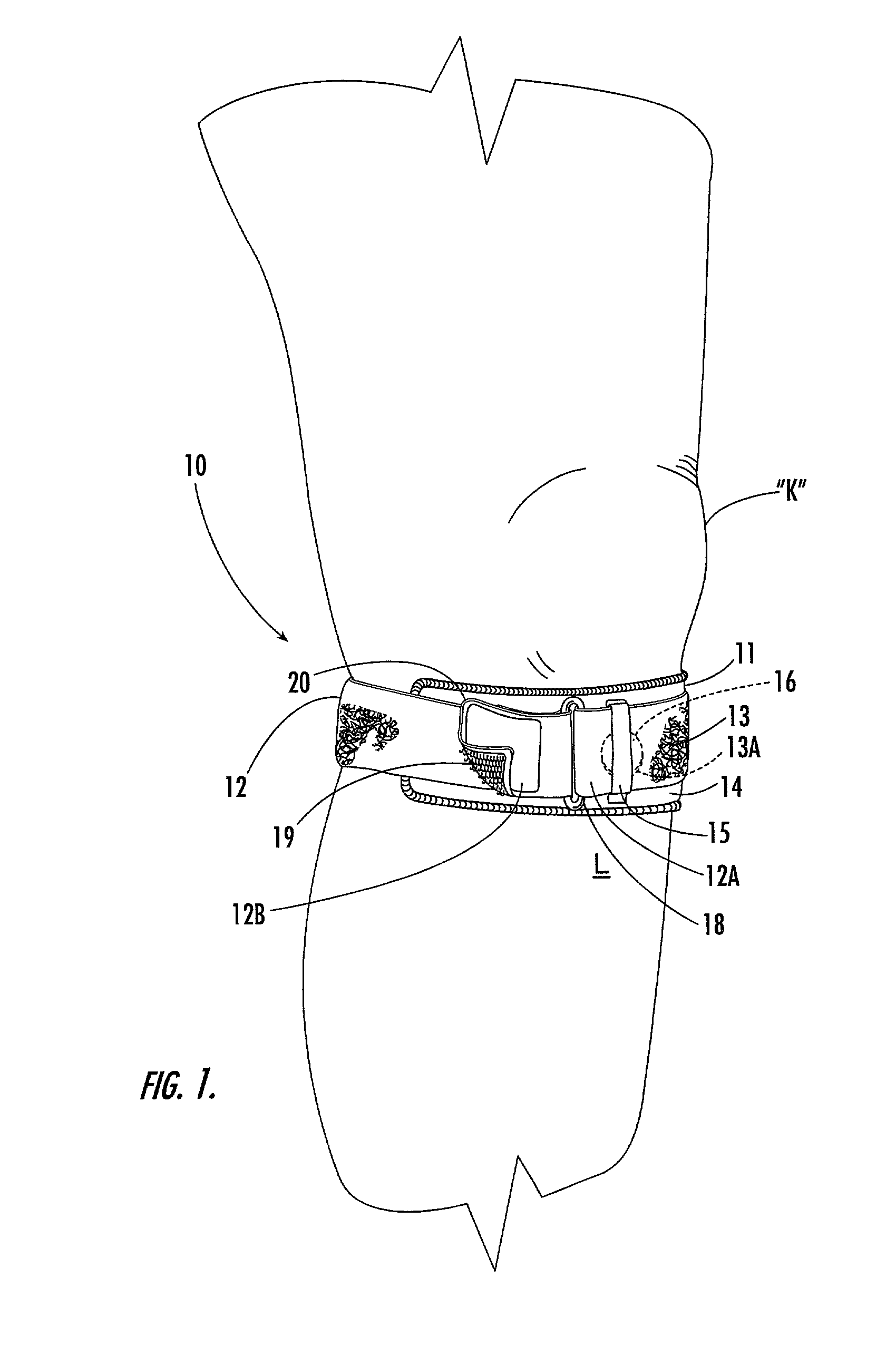 Custom-moldable support for patellar tendinitis