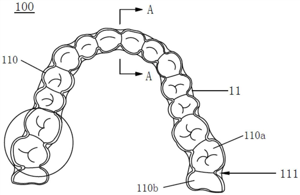 Design method and manufacturing method of shell-shaped tooth appliance