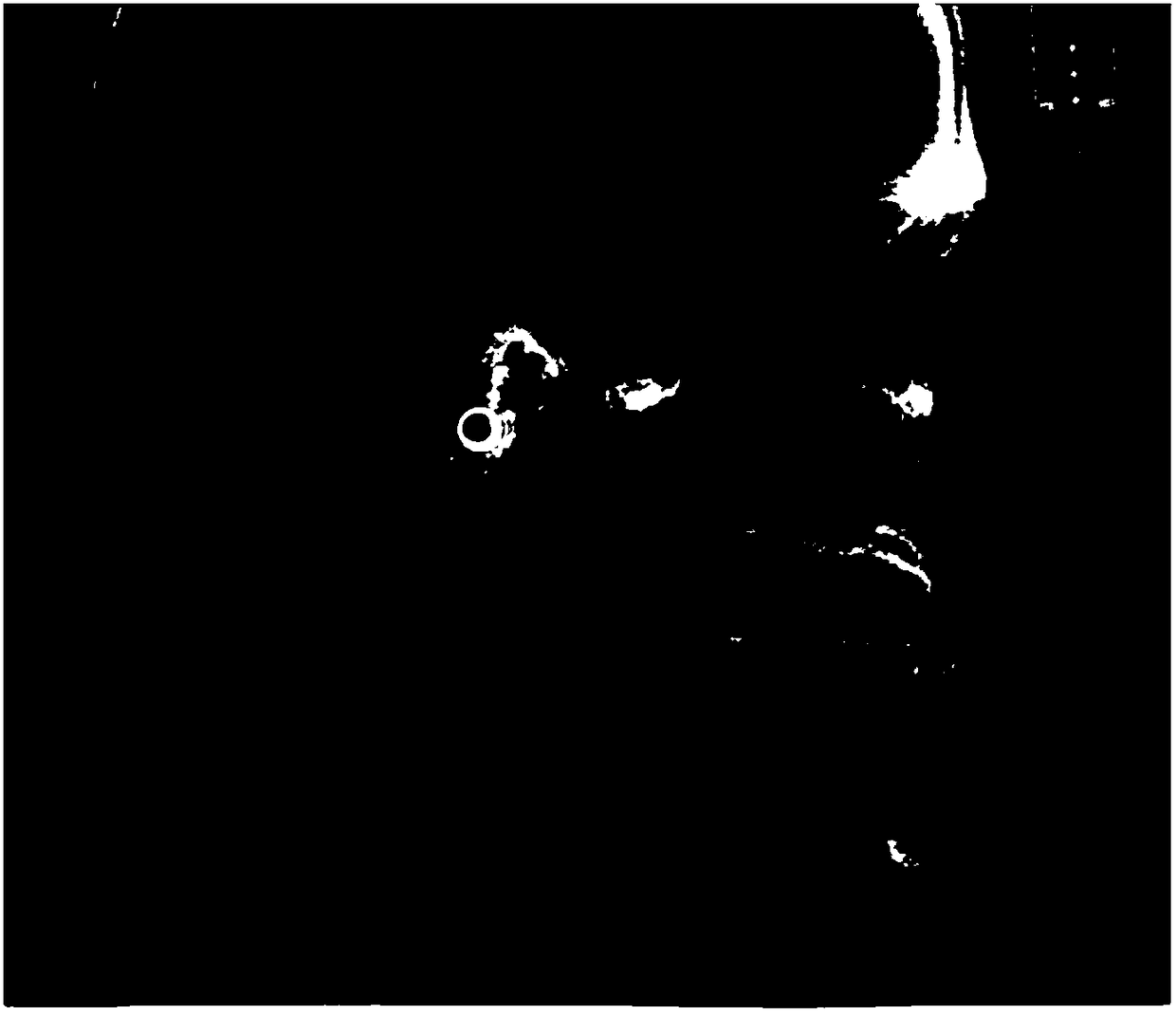 Soft palate morphology and development detection method