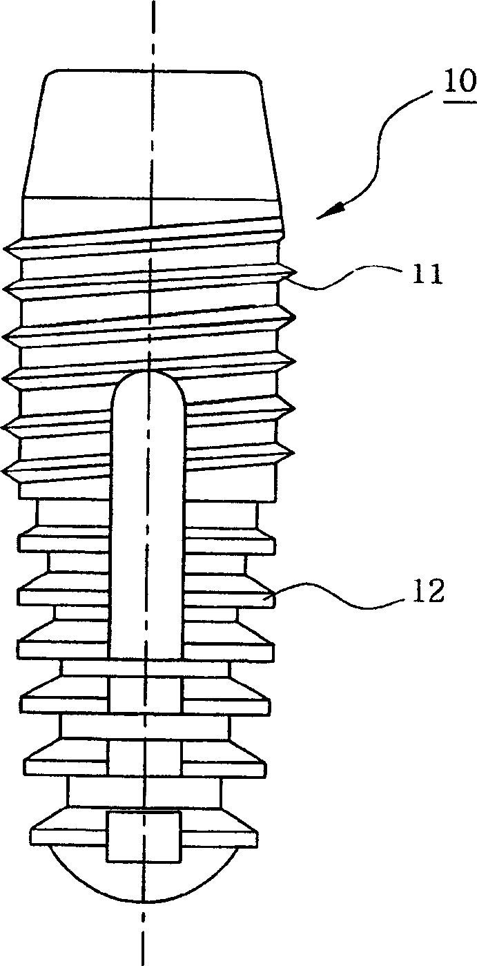 Dental implant fixture