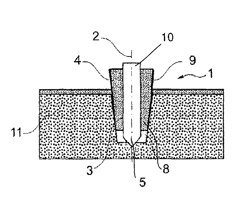 Fixation device with magnesium core