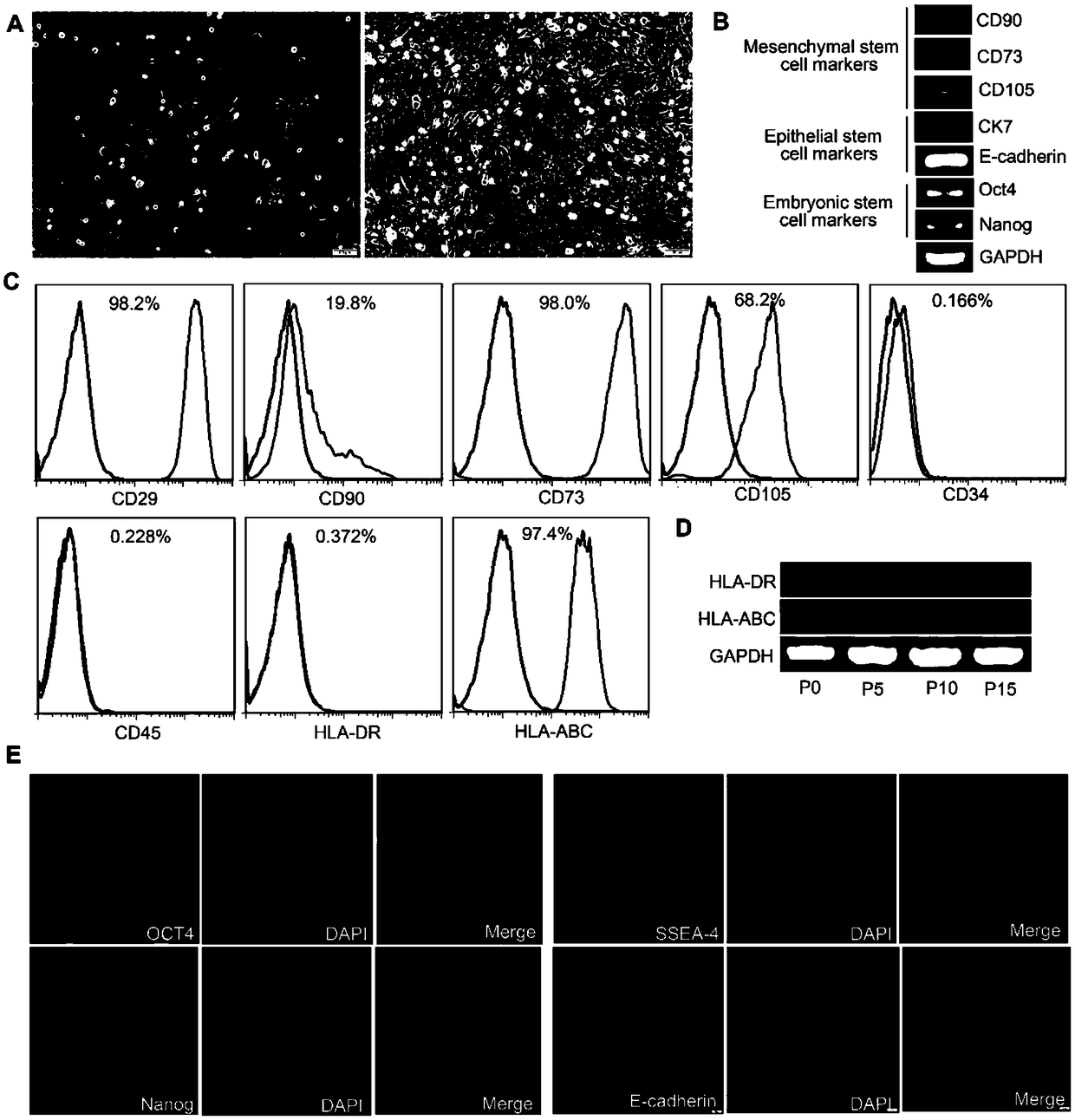 Method for inducing and differentiating amniotic epithelial stem cells into functional liver cells and application of method