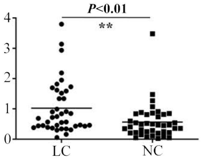 Application of CETP detection reagent in preparation of lung cancer screening kit