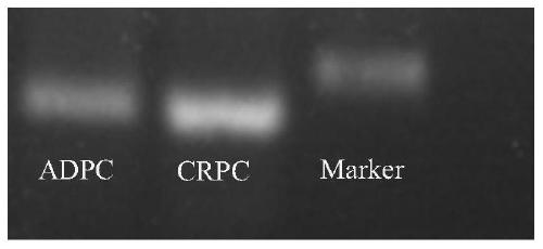 A kind of circRNA related to prostate cancer and its application