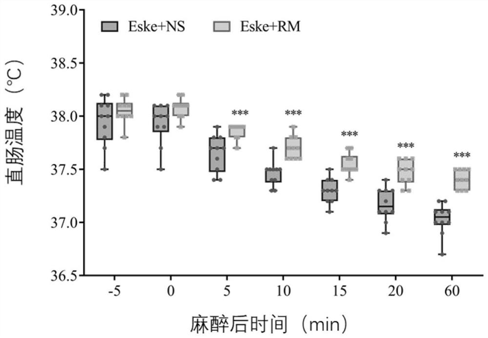 Application of remazolam in prevention of hypothermia and shivering in perioperative period