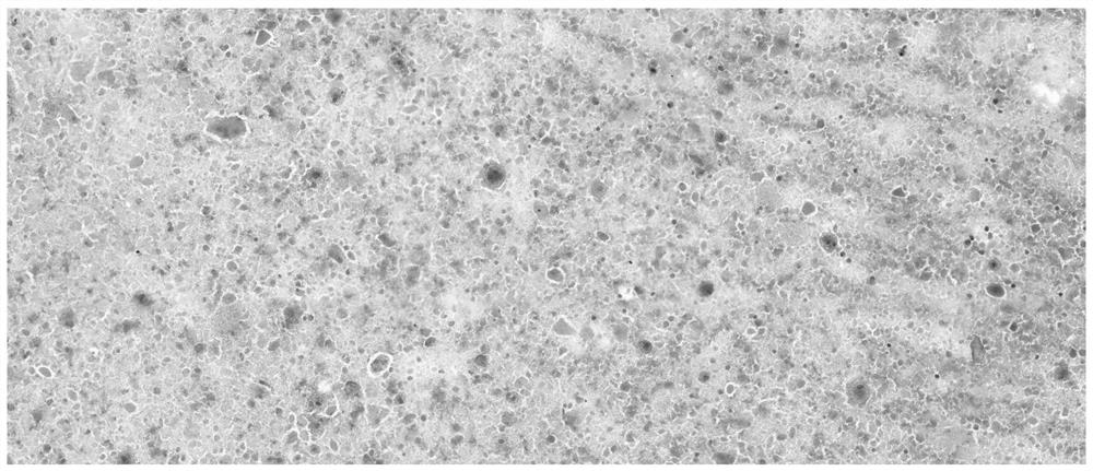 Method for separating and extracting cells from bronchoalveolar lavage fluid