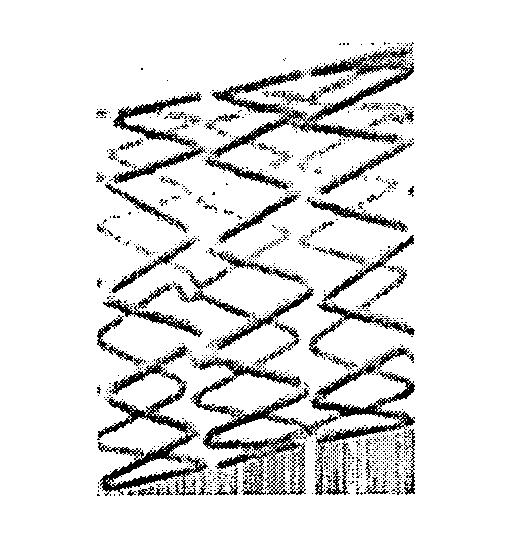 Vascular stent design