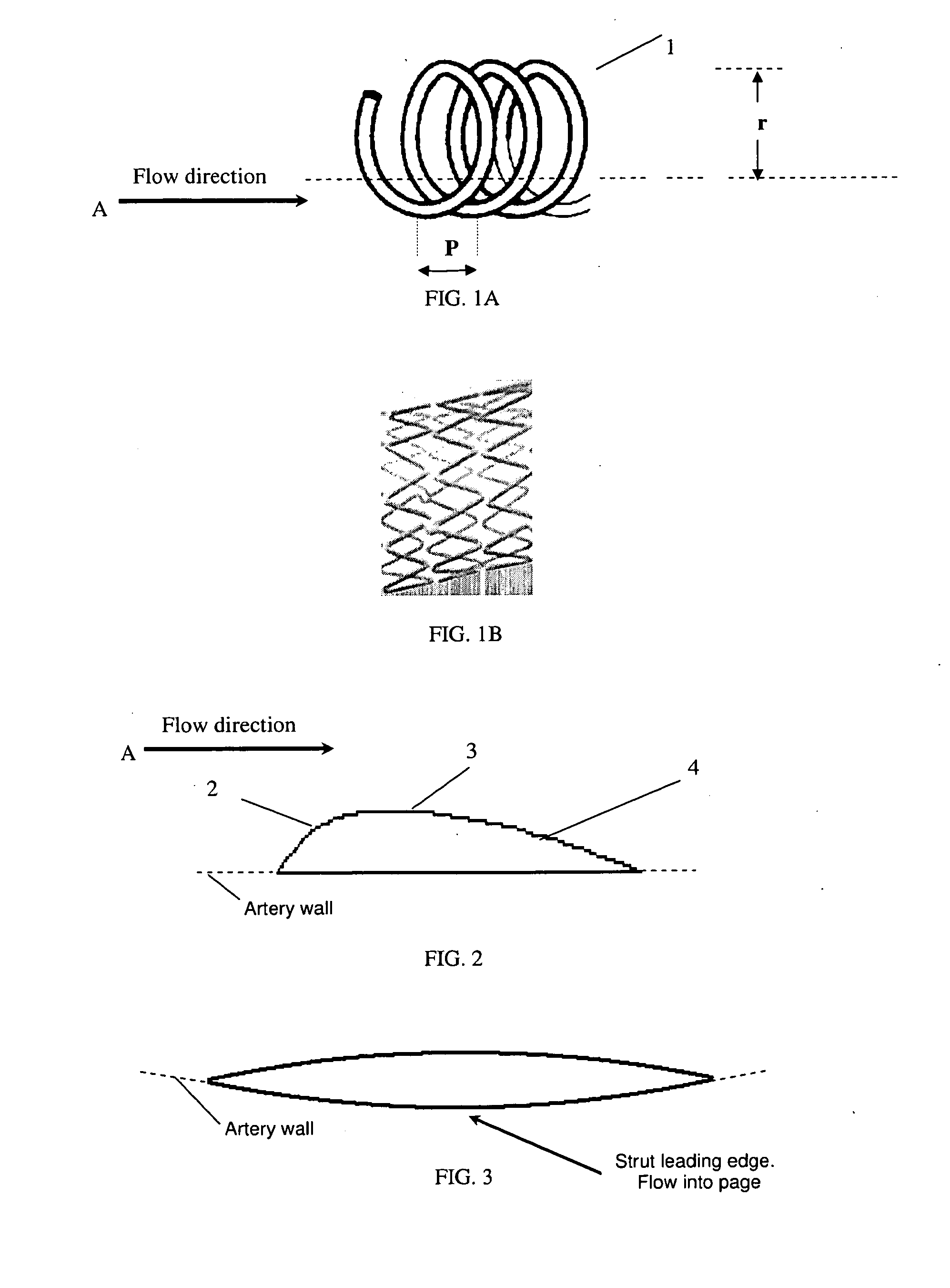 Vascular stent design