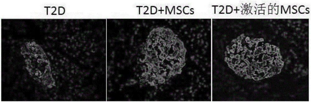 High-glucose activated mesenchymal stem cell injection and application thereof for diabetic drugs