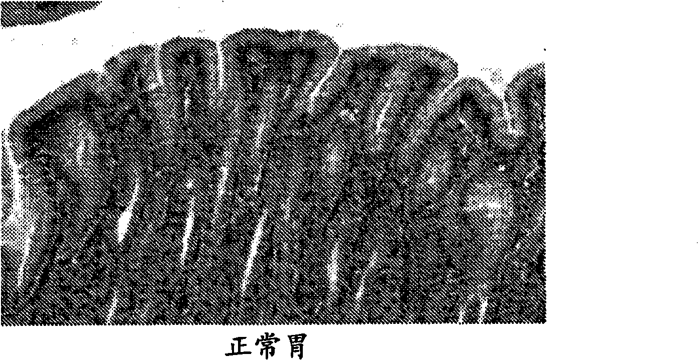 Microrna-based methods and compositions for the diagnosis, prognosis and treatment of gastric cancer