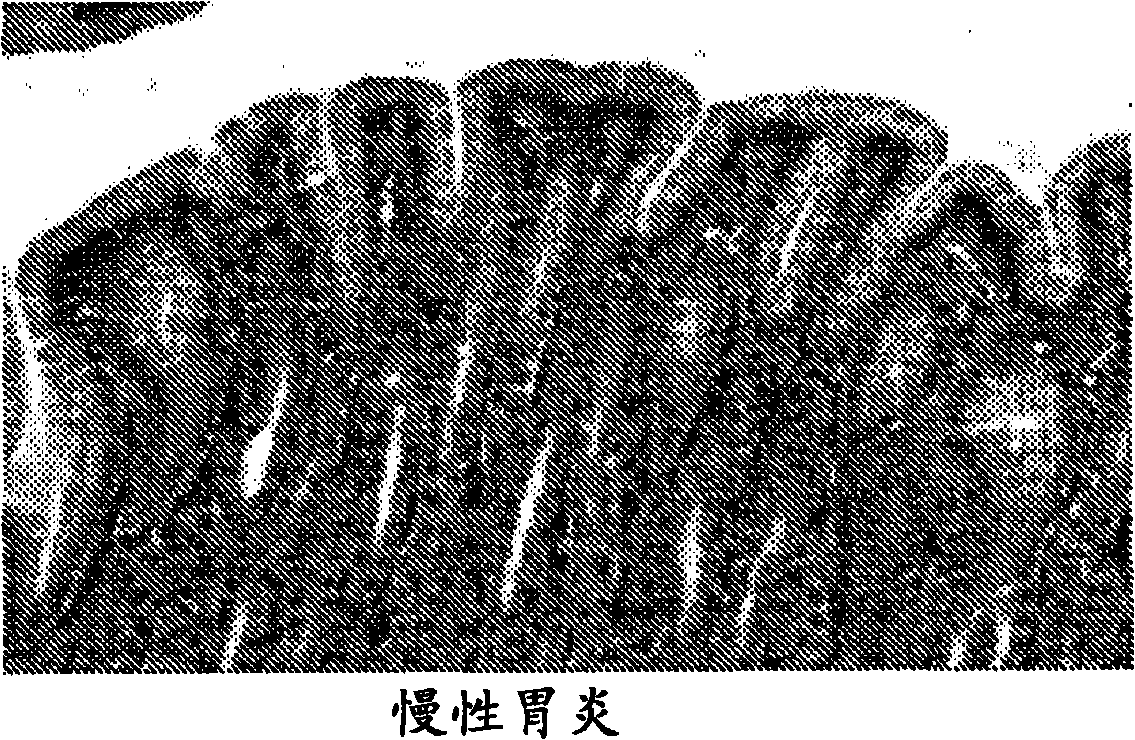 Microrna-based methods and compositions for the diagnosis, prognosis and treatment of gastric cancer