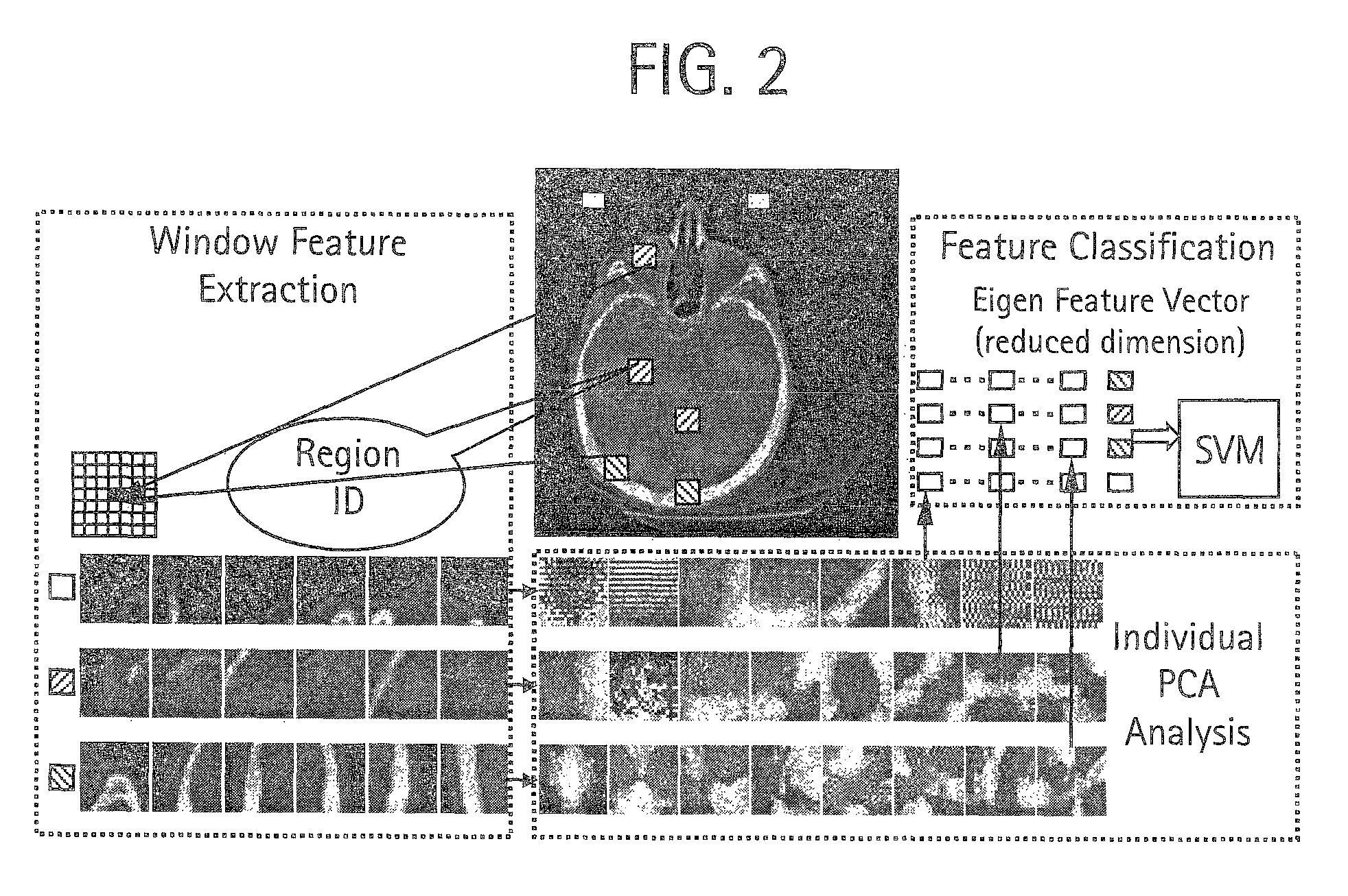 Machine learning based triple region segmentation framework using level set on PACS