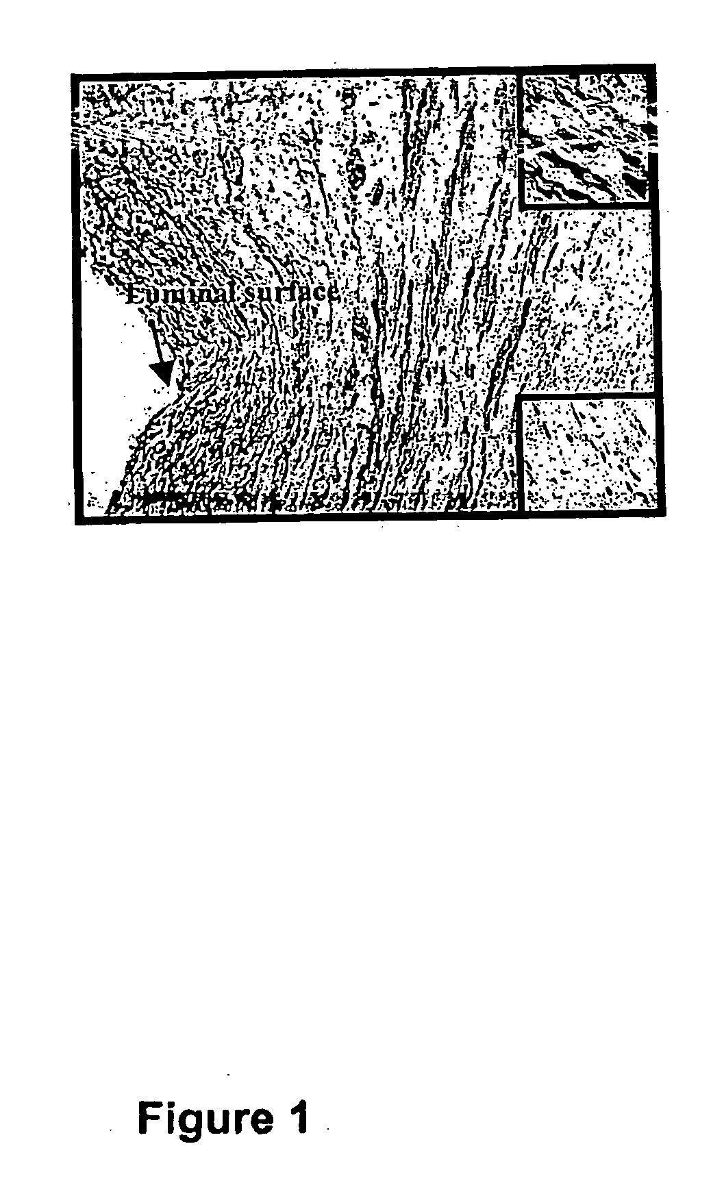 Methods and compositions for the treatment of graft failure