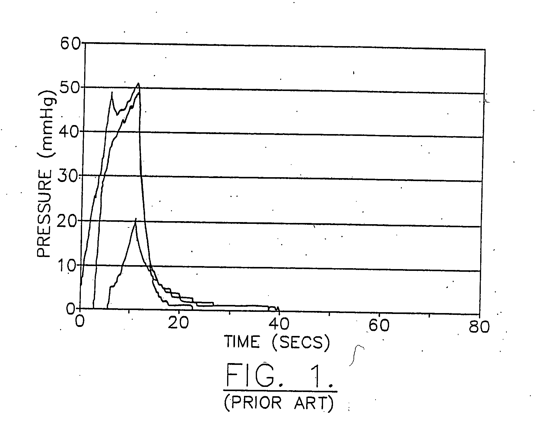 Universal connecting device that designates an operational mode