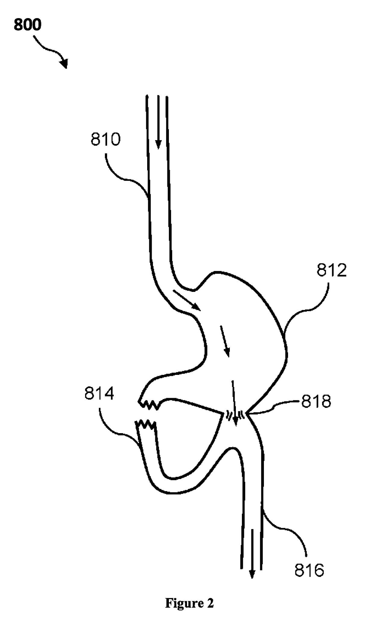 Composition and method for treatment of metabolic disorders