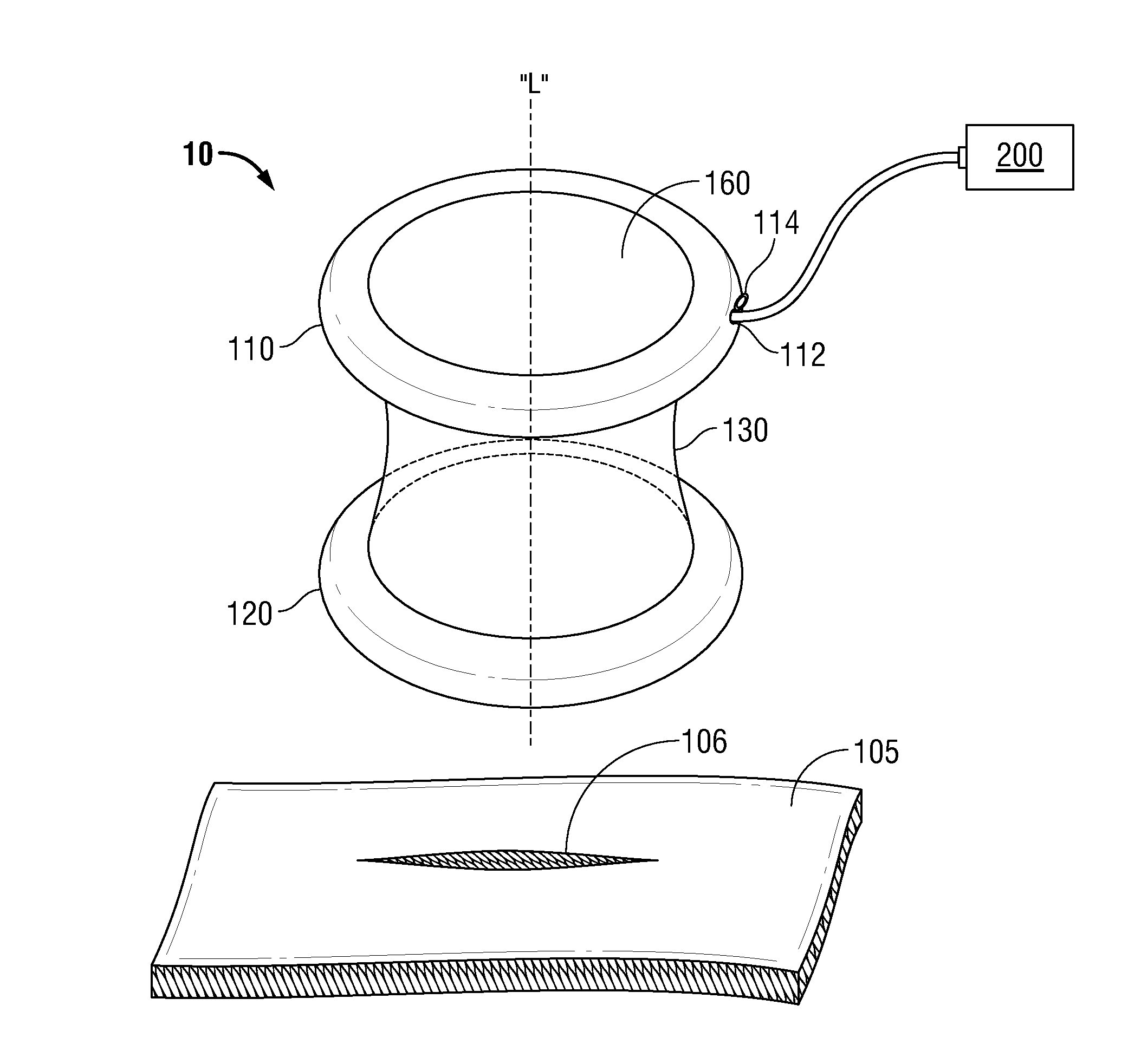 Wound retractor including rigid ring