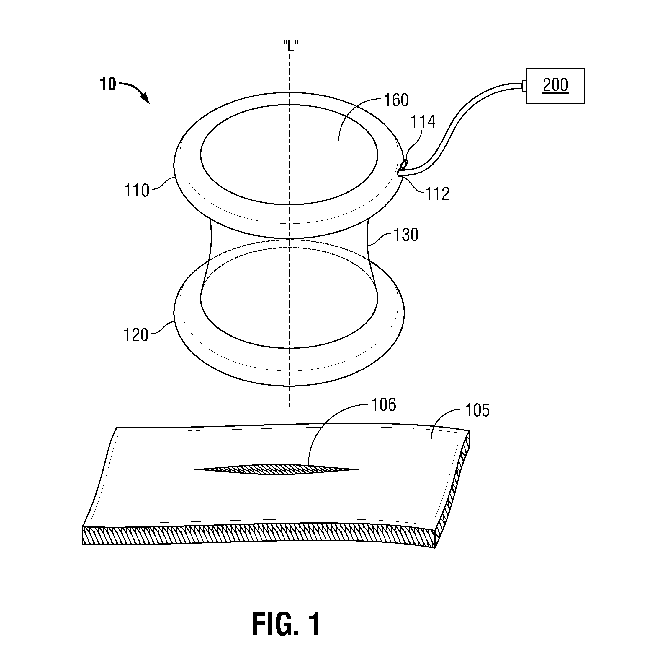 Wound retractor including rigid ring