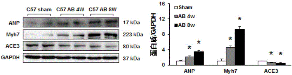 Function and application of angiotensin invertase (ACE3) in treating cardiac hypertrophy