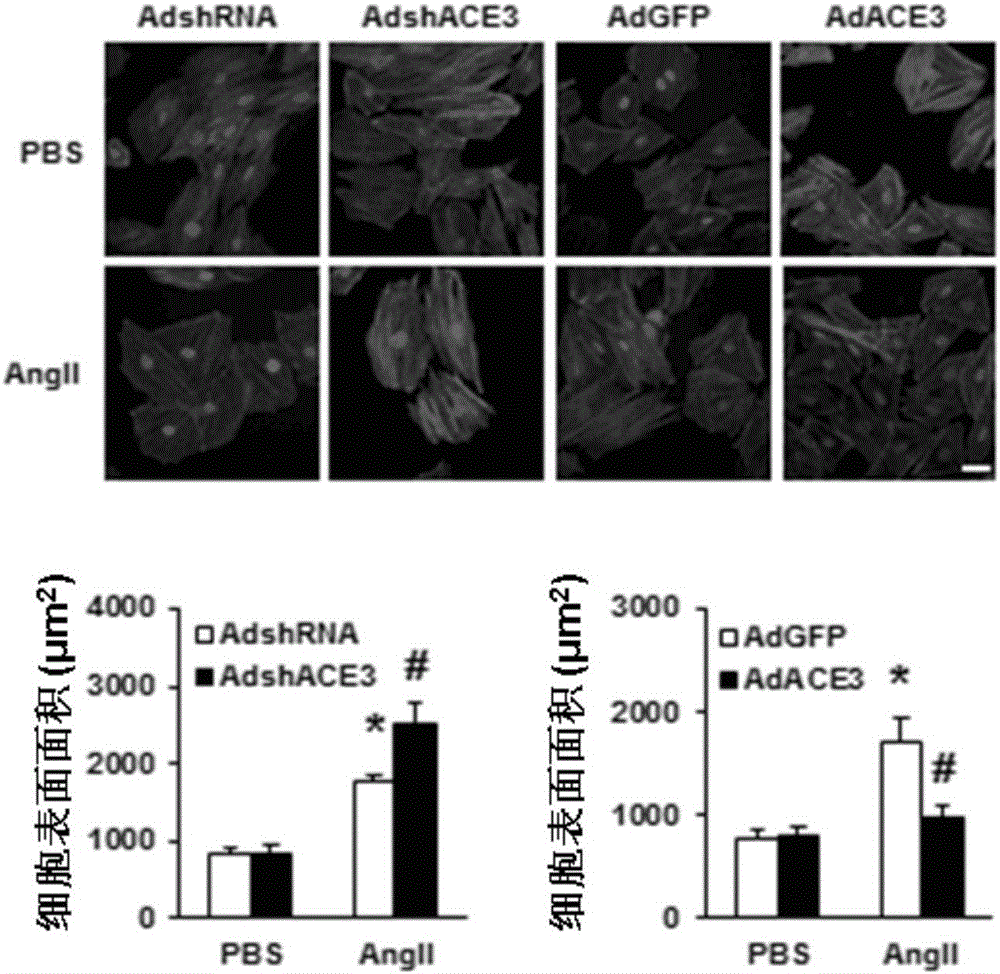 Function and application of angiotensin invertase (ACE3) in treating cardiac hypertrophy