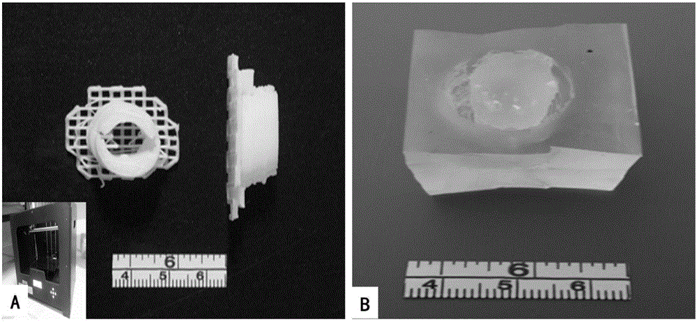 Method for constructing segmental personalized human urethral three-dimensional stent material