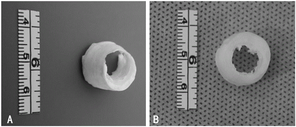 Method for constructing segmental personalized human urethral three-dimensional stent material