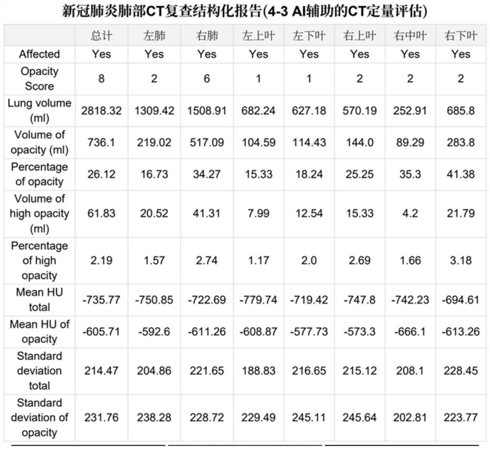 Method and system for automatically generating image structured report template