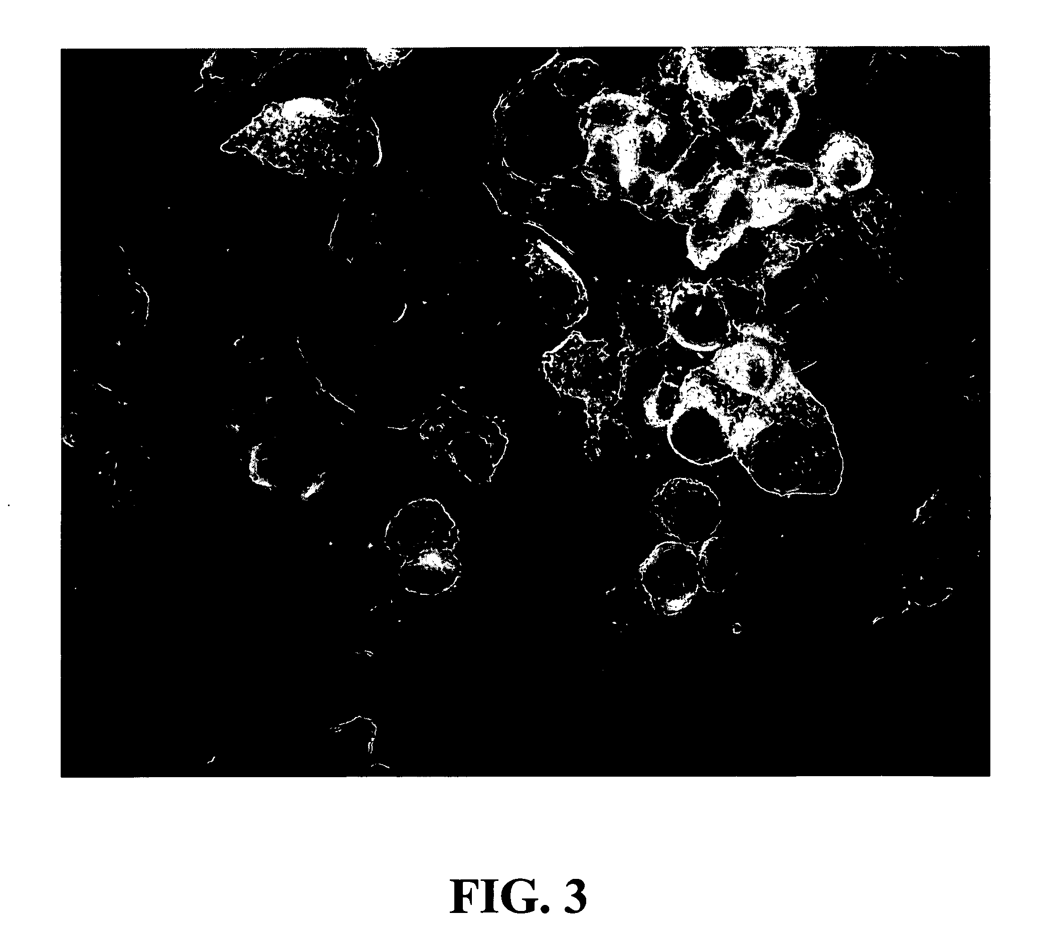 Diagnostic assay for the human virus causing severe acute respiratory syndrome (SARS)