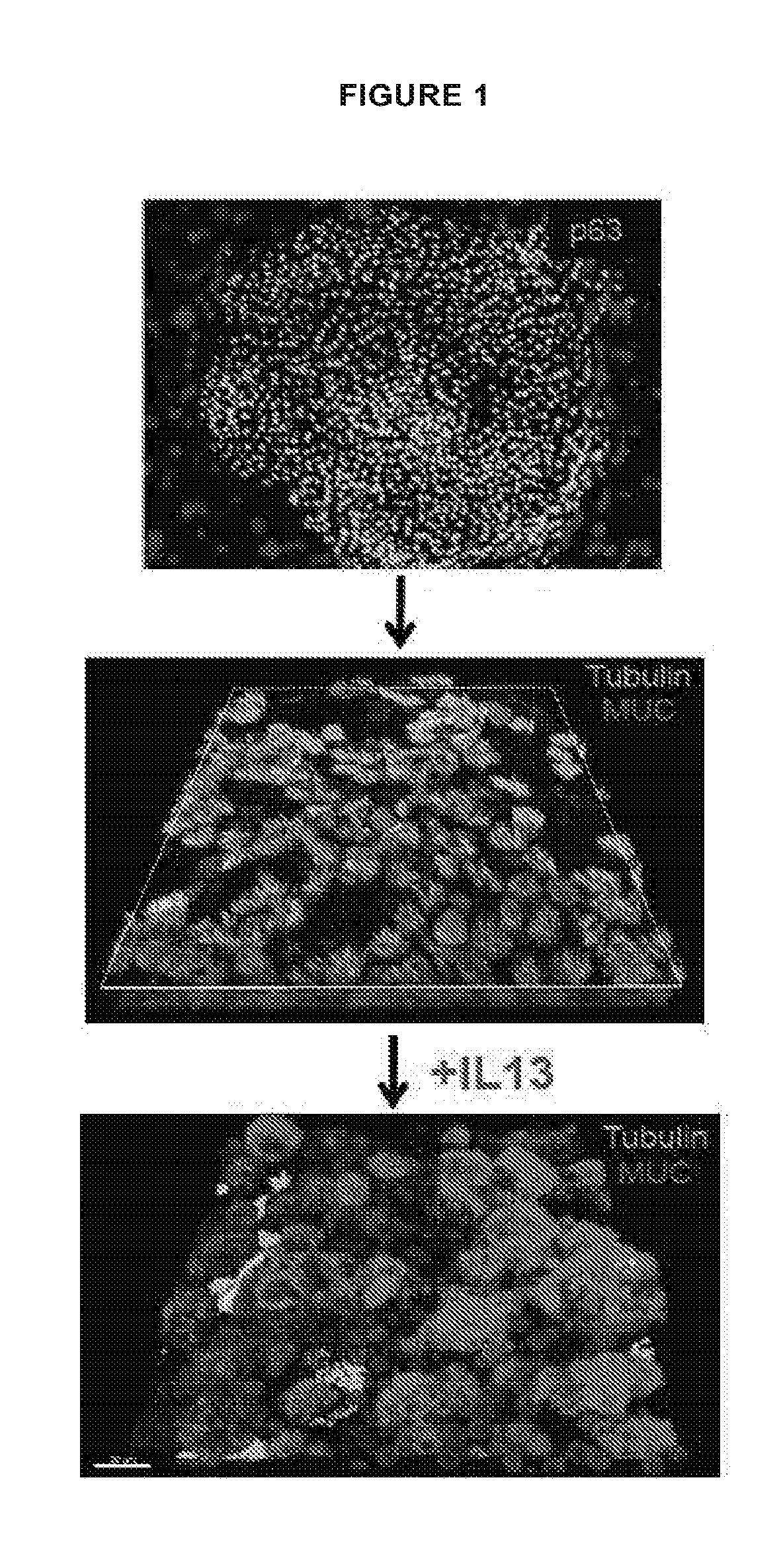 Treatment of inflammatory diseases