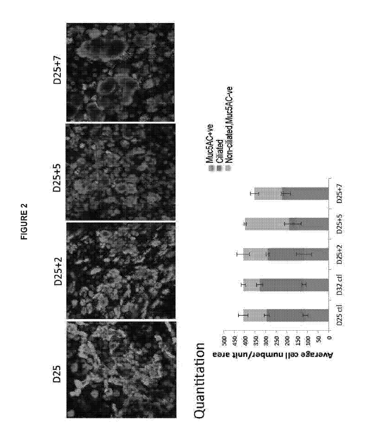 Treatment of inflammatory diseases