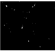 Method for preparing human adipose tissue-derived stromal cells