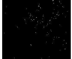 Method for preparing human adipose tissue-derived stromal cells