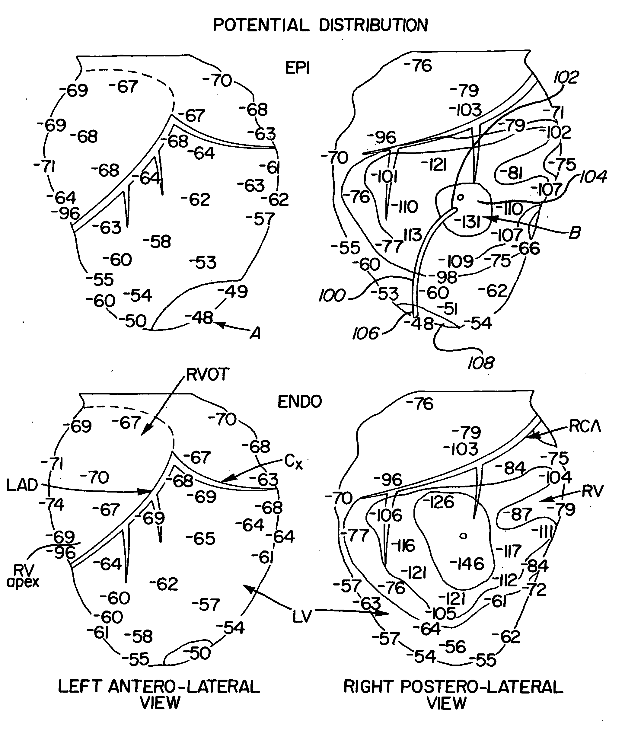 Method and apparatus for passive cardiac stimulation