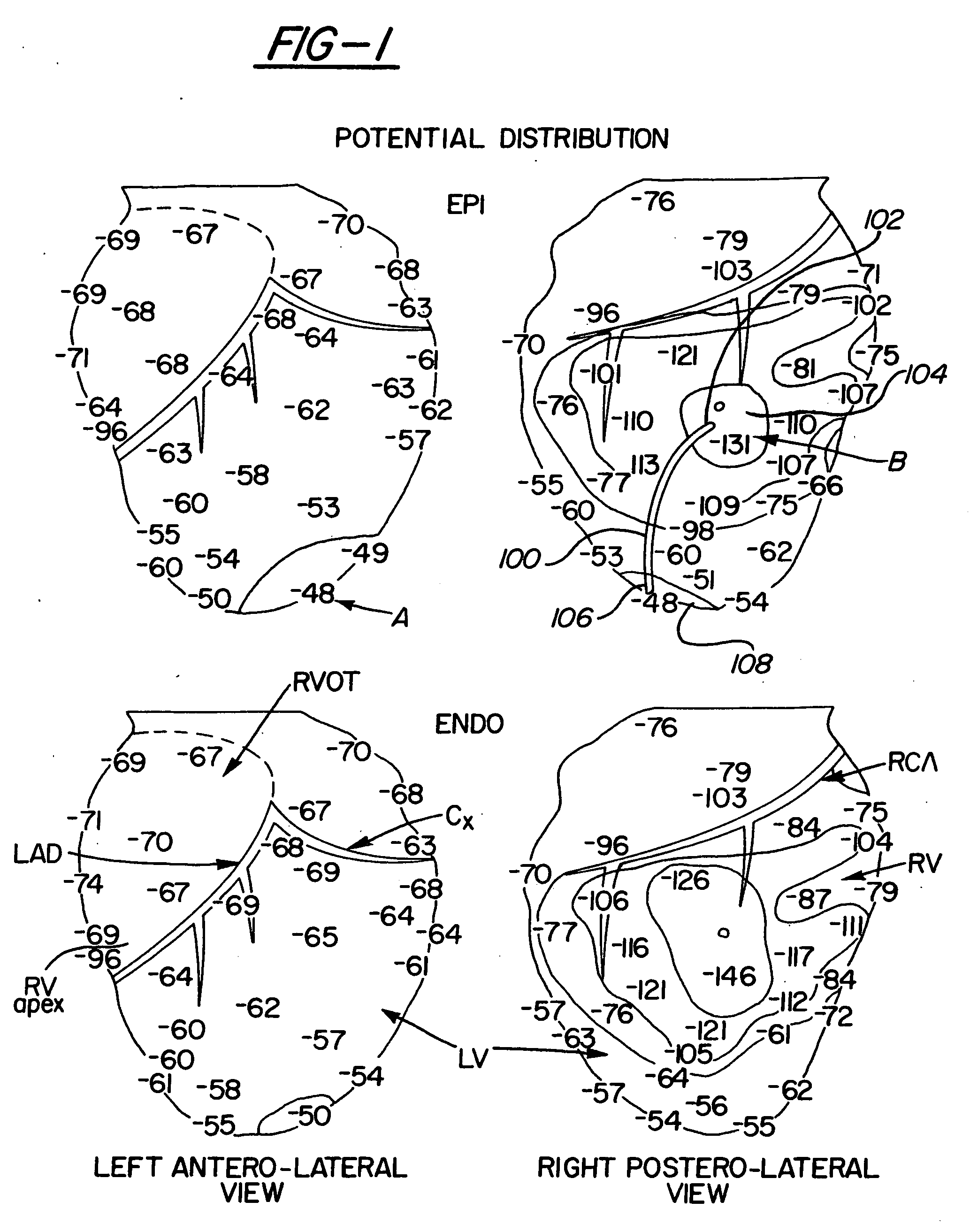 Method and apparatus for passive cardiac stimulation