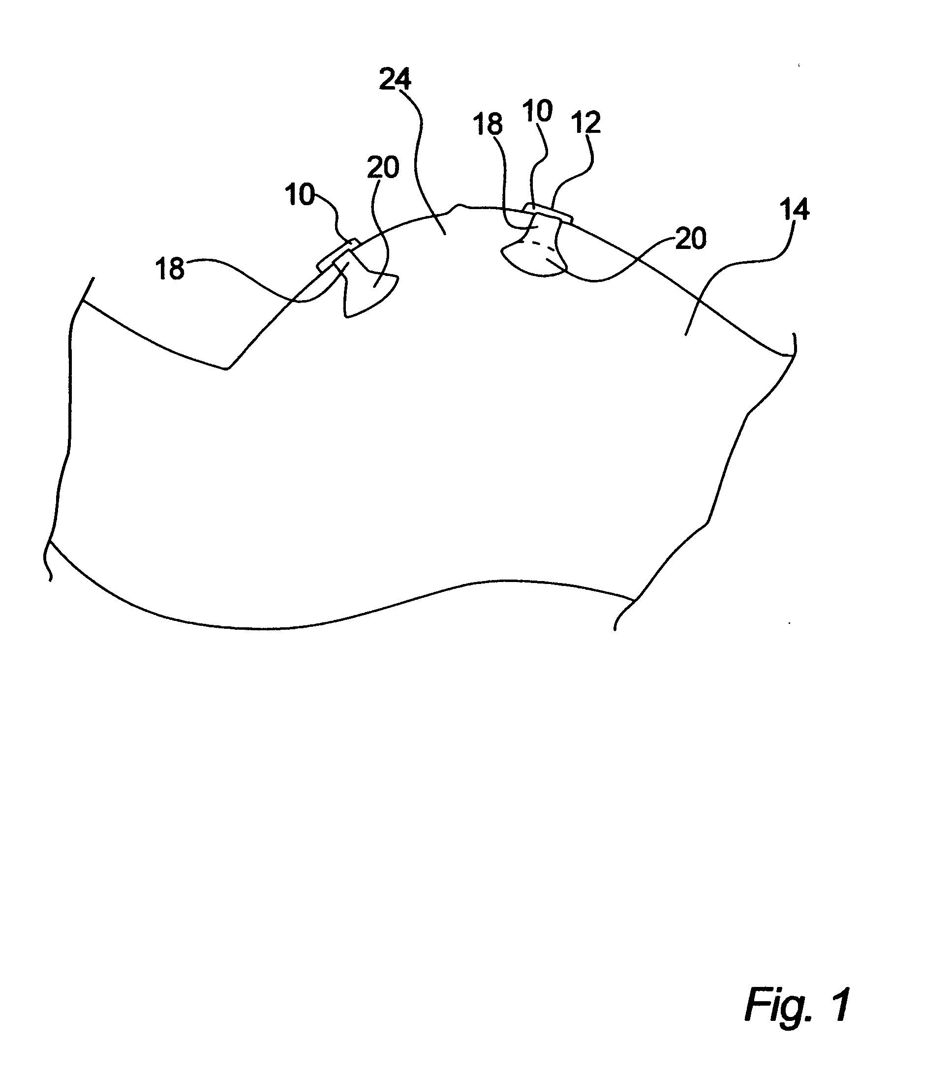 Adhesive strap for foetal monitoring transducers and the like