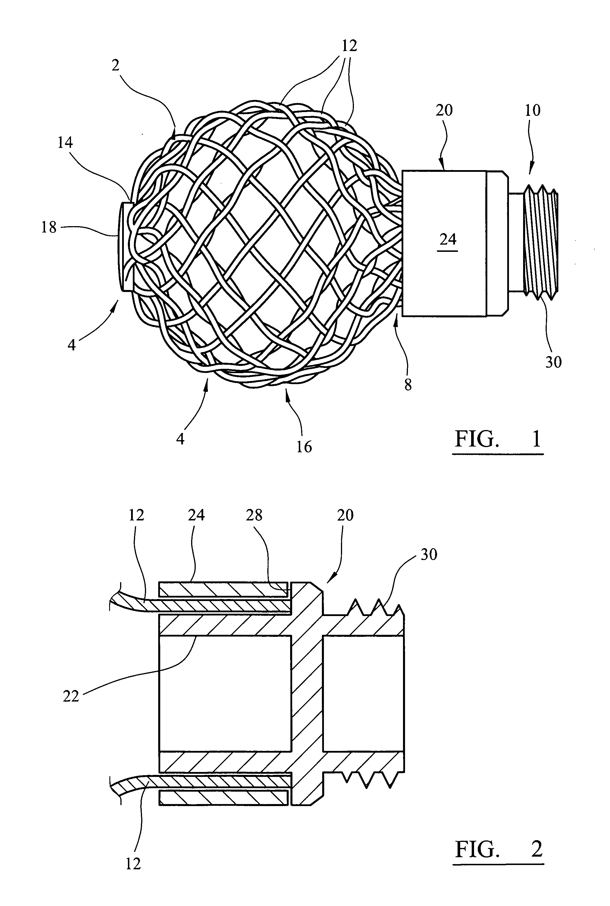 Support structure implant for a bone cavity