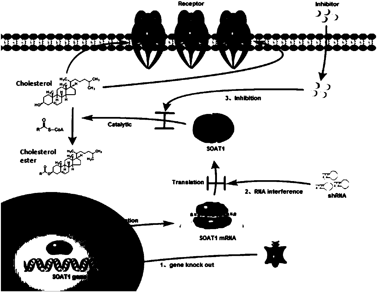 CAR-T cells inhibited by cholesterol translipase SOAT1, preparation method and application thereof