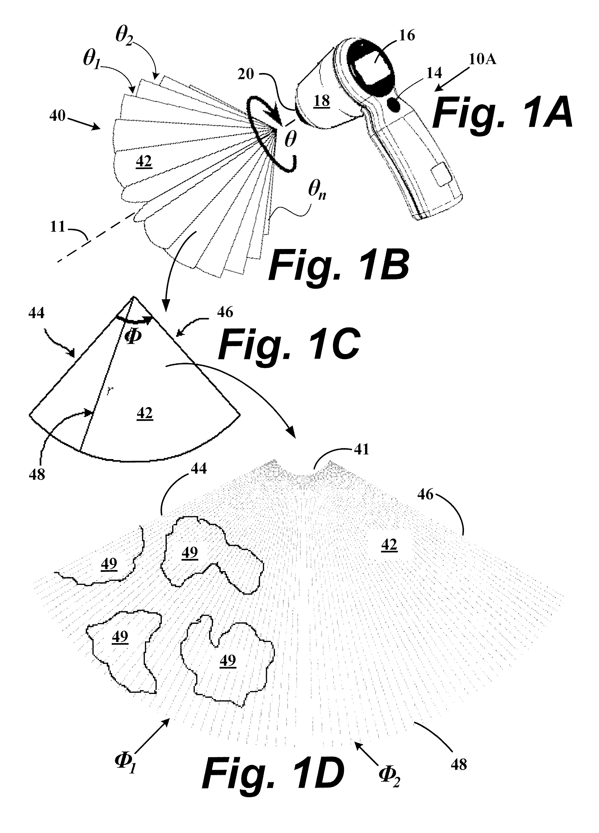 System and method for measuring bladder wall thickness and presenting a bladder virtual image