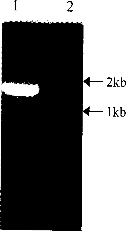 Medlar carotenoid synthase gene lycB and plasmid comprising the gene