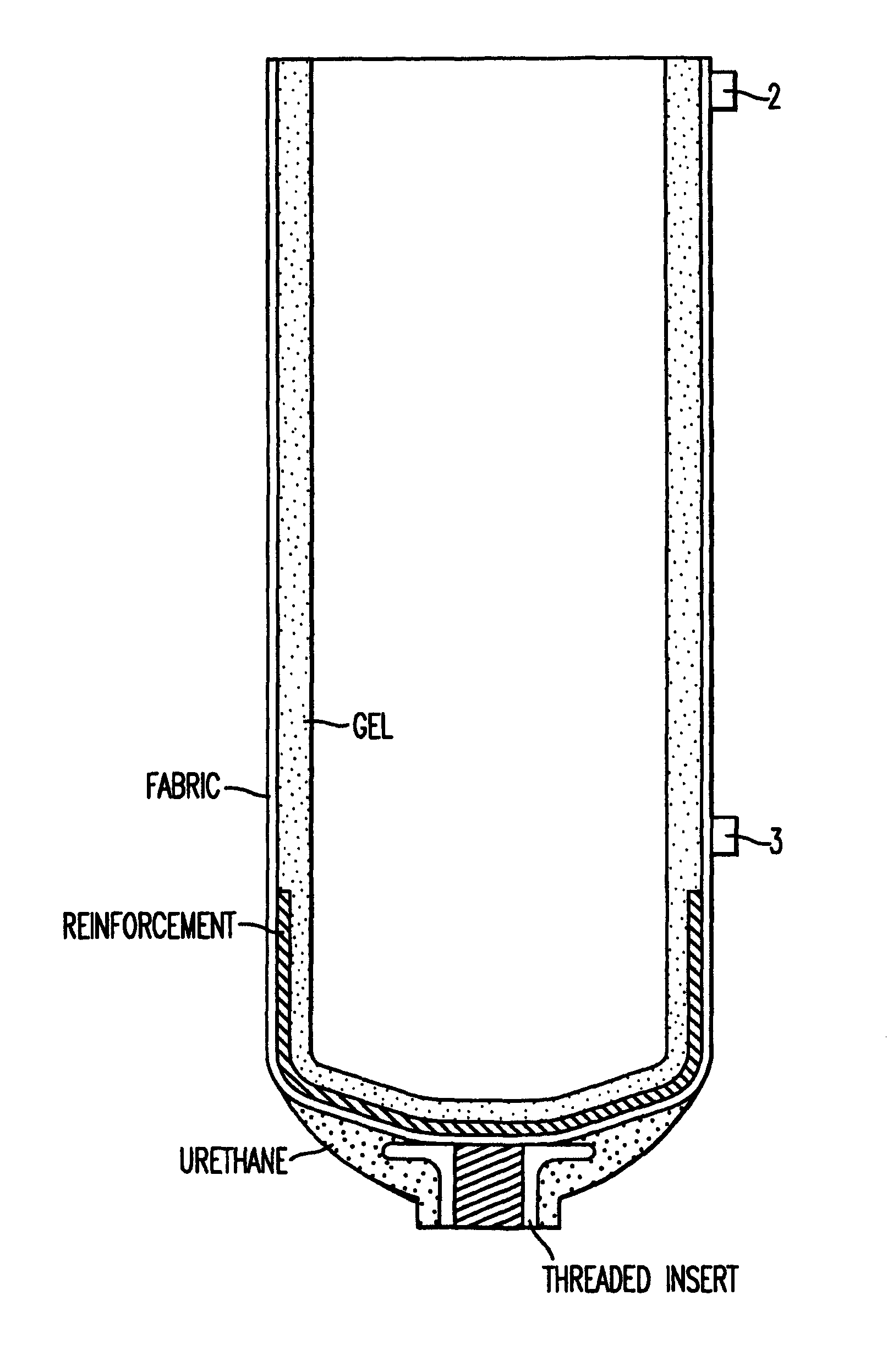 Prosthetic socket interface and assembly