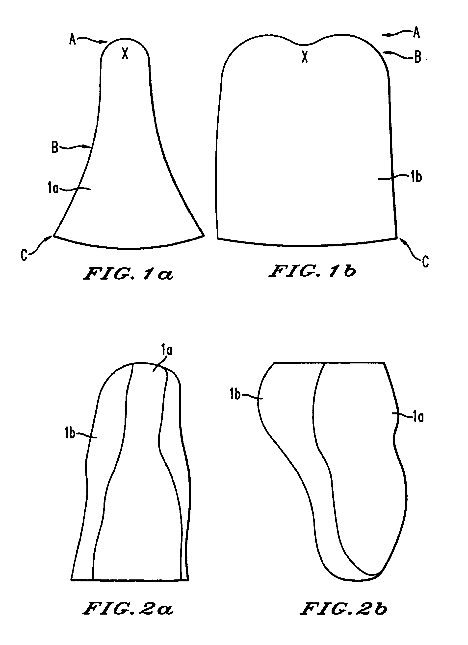 Prosthetic socket interface and assembly