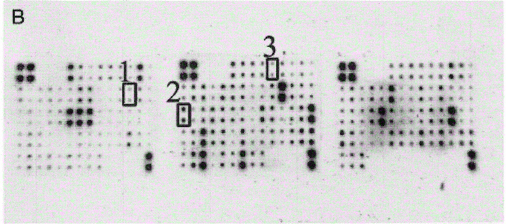 Preparation method of immunochromatographic test strip for detecting premature rupture of membrane