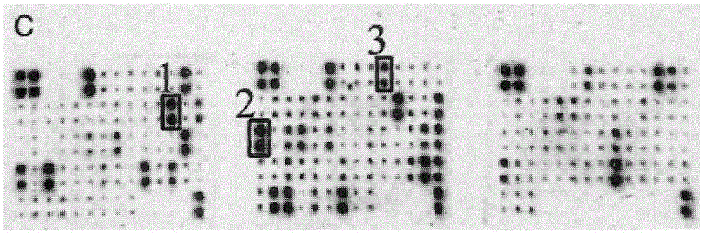 Preparation method of immunochromatographic test strip for detecting premature rupture of membrane