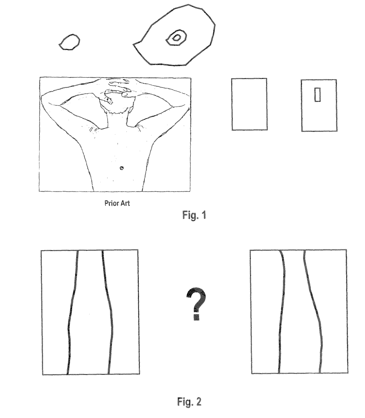 Solo home user skin imaging method, alignment aid, and chromatic filter for detecting growth of early melanomas