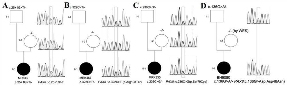 The diagnostic markers and application of mrkh syndrome